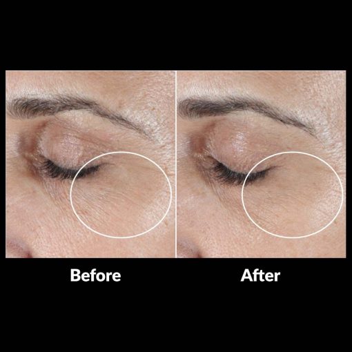 SkinMedica® HA5 Rejuvenating Hydrator