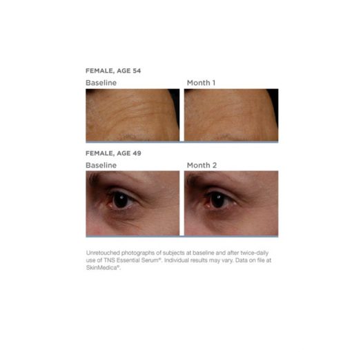 SkinMedica® TNS Advanced+ Serum®