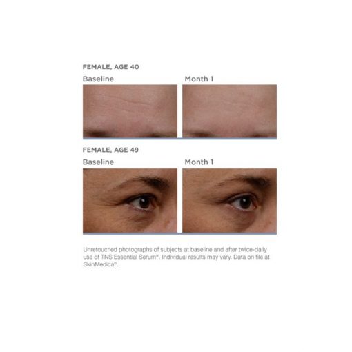 SkinMedica® TNS Advanced+ Serum®