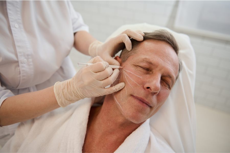 How a Deep Plane Facelift Is Performed How a Deep Plane Facelift Is Performed