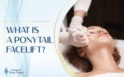 What Is a Ponytail Facelift? What Is a Ponytail Facelift?