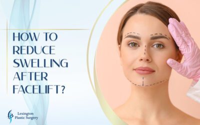 How to Reduce Swelling After Facelift How to Reduce Swelling After Facelift