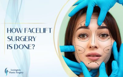 How Facelift Surgery Is Done
