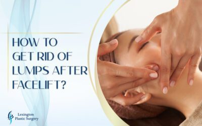 How to Get Rid of Lumps After Facelift How to Get Rid of Lumps After Facelift