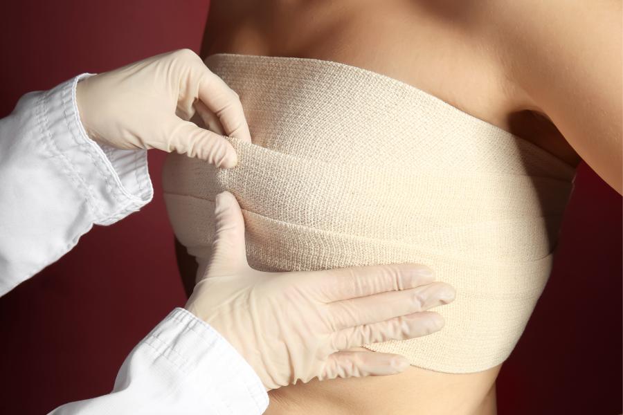 Timeline Breakdown: Length of the Breast Augmentation Process Timeline Breakdown: Length of the Breast Augmentation Process