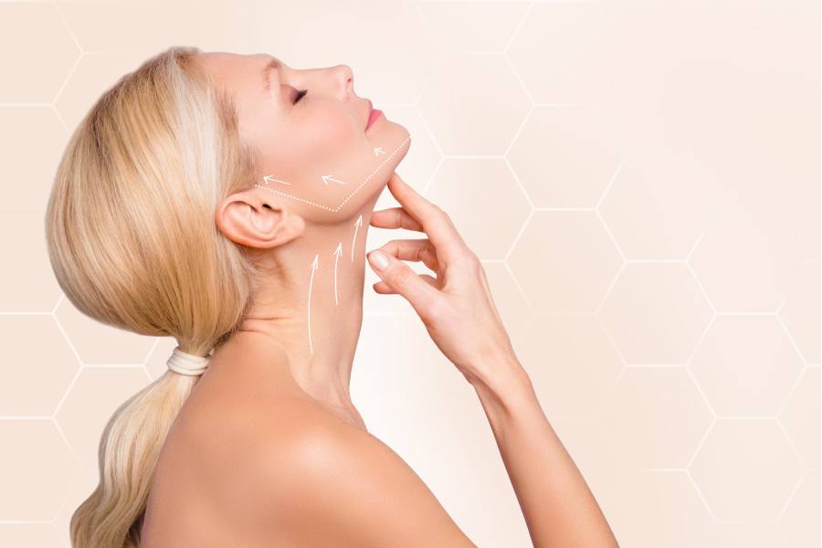 Neck Lift Neck lift