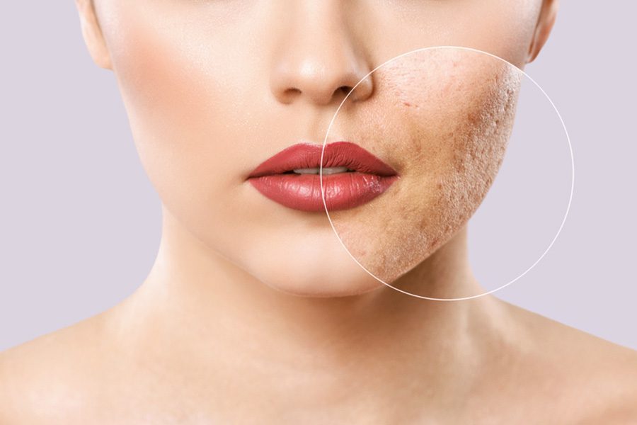 Can Plastic Surgery Get Rid of Scars Can Plastic Surgery Get Rid of Scars