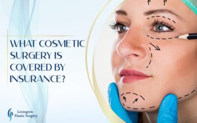 What Cosmetic Surgery Is Covered by Insurance? What Cosmetic Surgery Is Covered by Insurance?